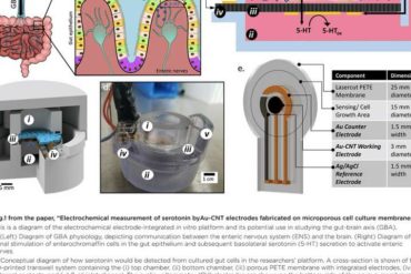 Symptoms all in your head—or in your gut? Maybe a little of both.
