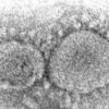 Virus may never go away but could change into mild annoyance