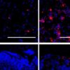 Delivering vaccines directly to the lungs can boost immune responses to respiratory infections or lung cancer: study