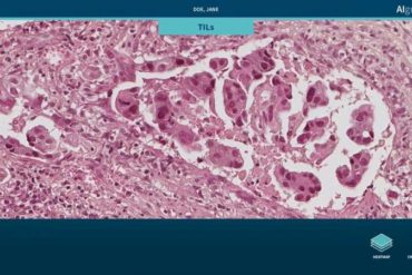 Making the role of AI in medicine explainable