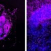 RNA detection method advances in situ transcriptomics with potential for a range of biomedical applications