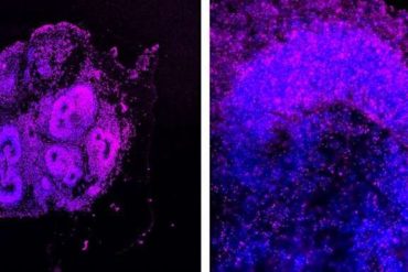 RNA detection method advances in situ transcriptomics with potential for a range of biomedical applications