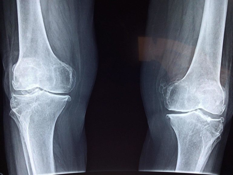 vuzix-knee-surgery.jpg