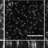 Microscopists push neural networks to the limit to sharpen fuzzy images