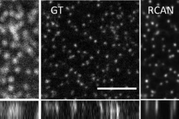 Microscopists push neural networks to the limit to sharpen fuzzy images