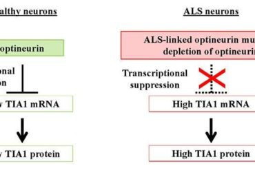 Scientists uncover key role for proteins involved in amyotrophic lateral sclerosis disease