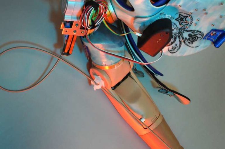 Cleveland Clinic researchers develop bionic arm that restores natural behaviors in patients with upper limb amputations
