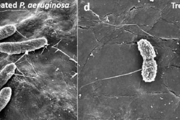 Gel fights drug-resistant bacteria and induces body’s natural immune defense