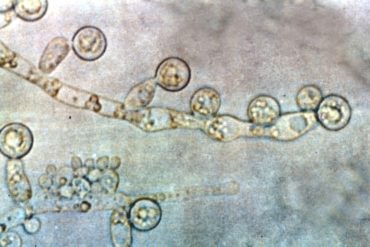 Breaking down fungal biofilm defenses provides potential path to treating sticky infections