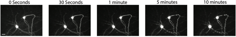 Time lapse of dying neuron over 10 minutes under a microscope