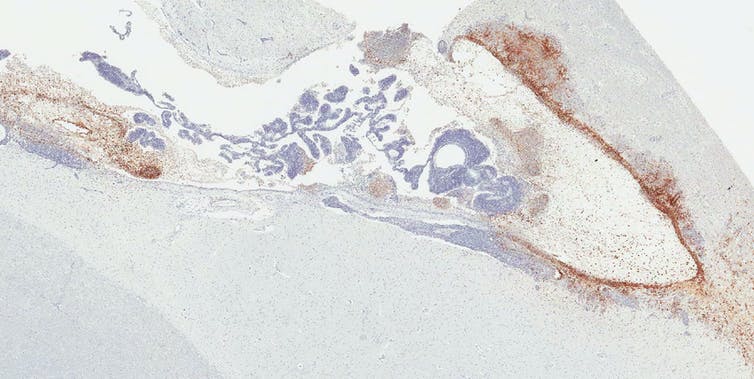 Ventricular system of rhesus monkey that survived Ebola virus infection, with brown stains indicating viral persistence lining the edges