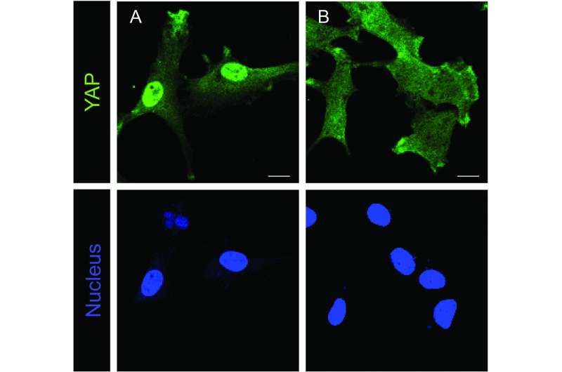 CNIC scientists identify a shuttle protein required for the nuclear import of proteins essential for organ growth and developmen