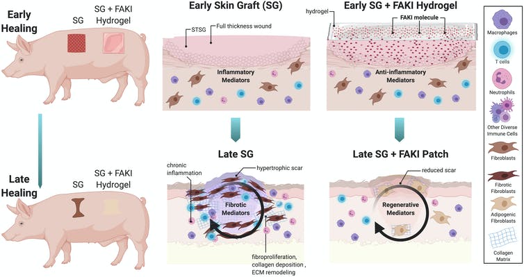 Diagram of pigs with skin grafts treated with or without drug (FAKI hydrogel), where skin grafts with drug had reduced inflammation and scar formation.