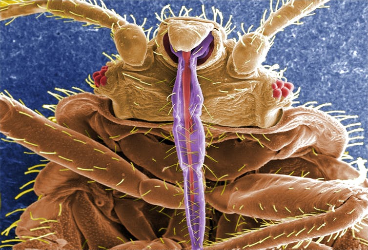closeup of the front underside of a brown insect