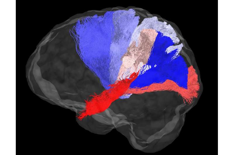 Using GPUs to discover human brain connectivity 