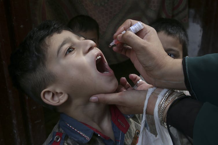 adult hands administer a drop of medicine to a boy with open mouth