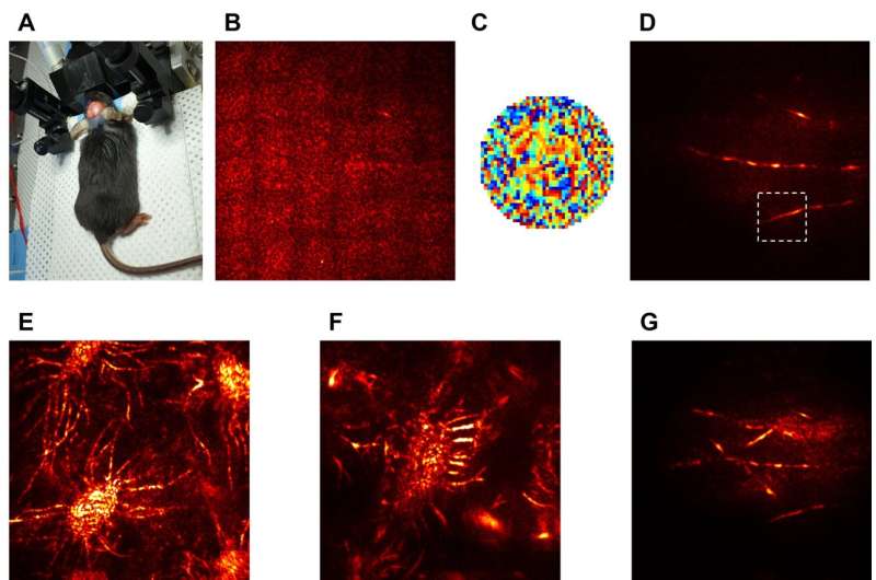 A new holographic microscope allows scientists to see through the skull and image the brain