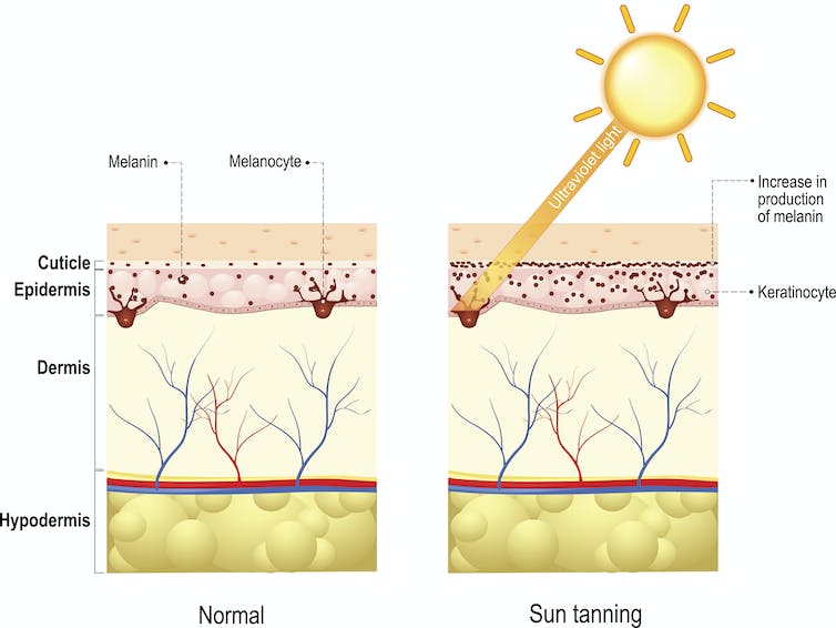 cross-sectional diagram of skin's layers with sunlight hitting the surface and showing increased production of melanin