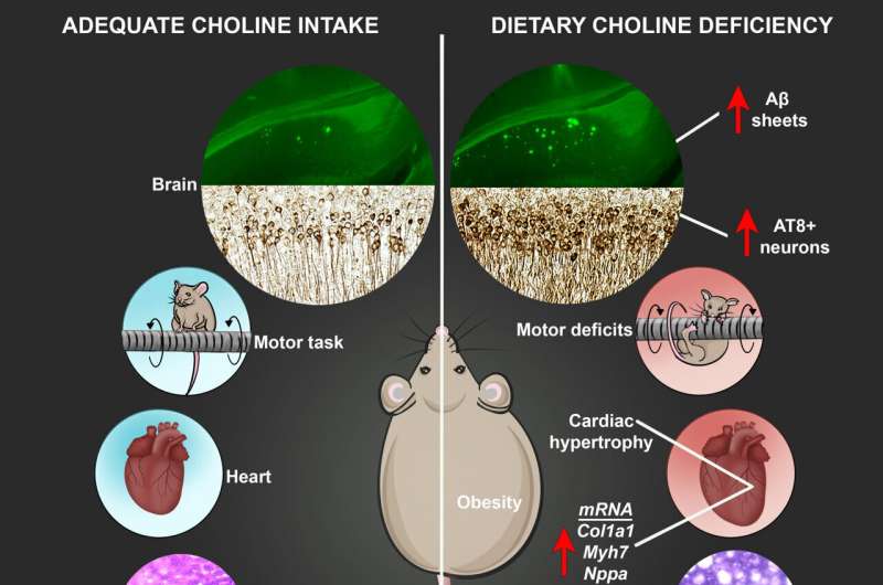 Study explores effects of dietary choline deficiency on neurologic and system-wide health