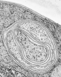 Microscopy image of endoplasmic reticulum surrounded by an autophagosome