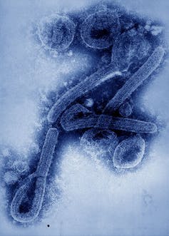 Microscopy image of Marburg virus particles