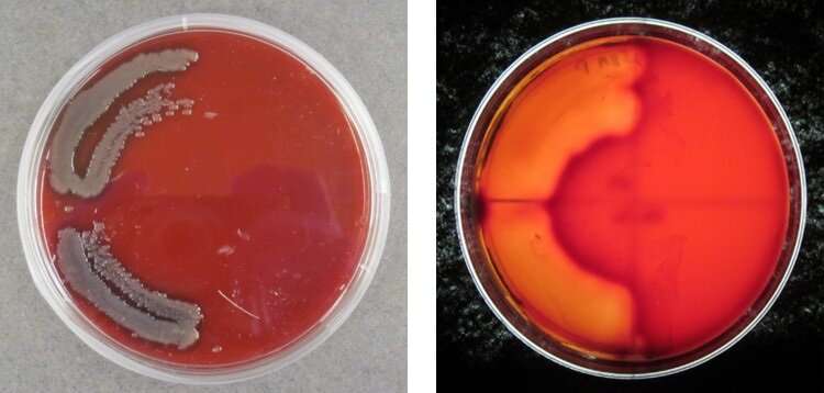 Perfect 'pathogen' storm: Vibrio bacteria, Sargassum and plastic marine debris
