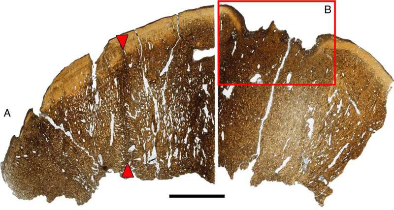 Did dome-headed dinosaurs sport bristly headgear?
