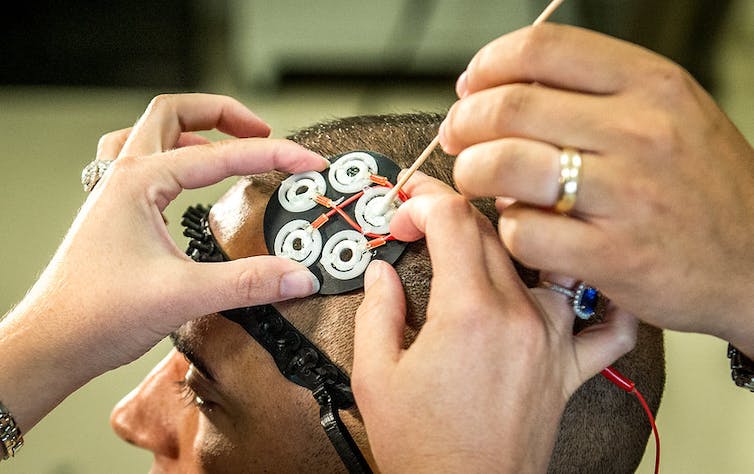 Electrodes being placed on a person's head