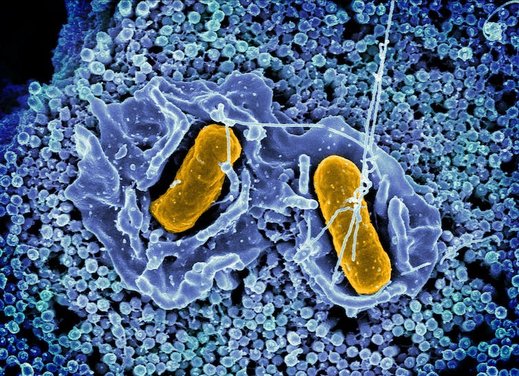 Microscopy image of Salmonella Typhimurium invading a human epithelial cell