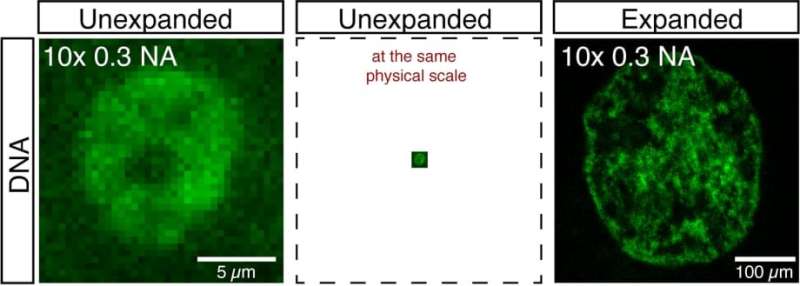 Supersize the cell: Unlocking genome secrets through expansion microscopy