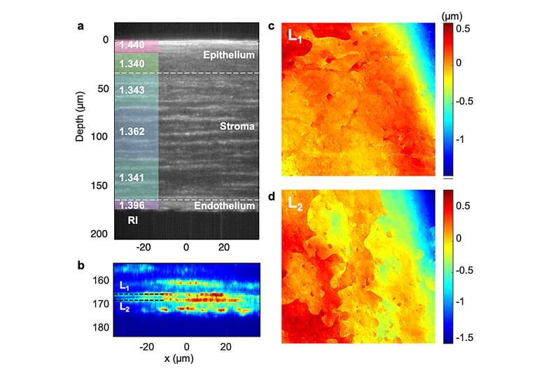 Speckle diffraction tomography reveals nanoscale features in thick biological specimens