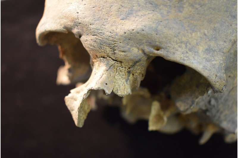 'Bone biographies' reveal lives of medieval England's common people—and illuminate early benefits system