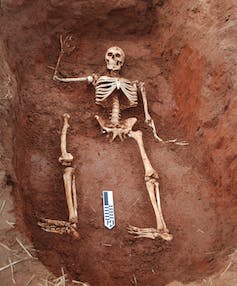 human skeleton model posed in bottom of dirt hole with ruler near feet