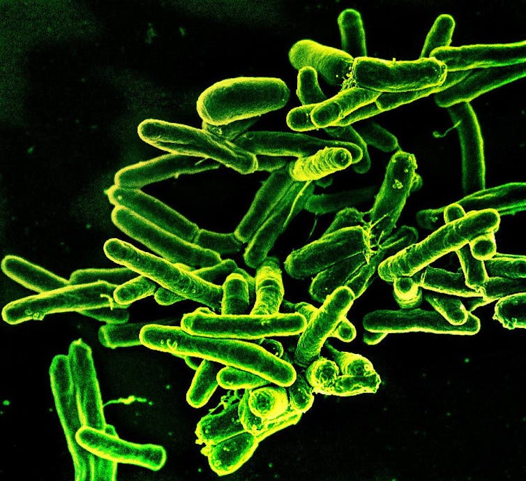 Microscopy image of rod-shaped TB bacteria stained green