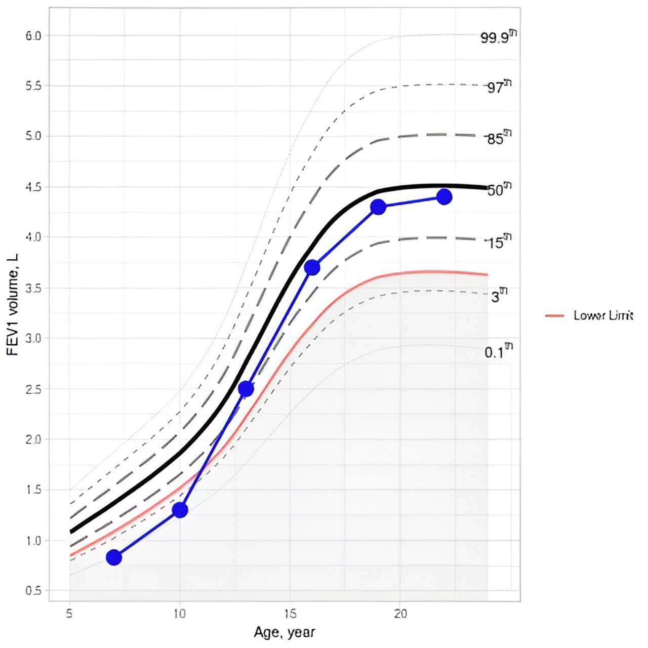 Q&A: New digital tool enables monitoring of lung function over time