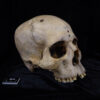 Extraordinary' 4,000-year-old Egyptian skull may show signs of ...