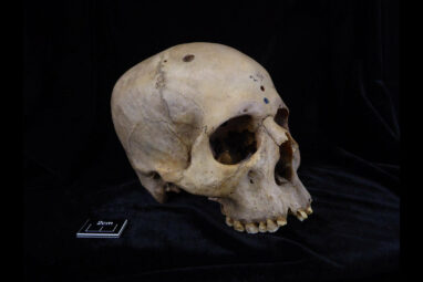 Extraordinary' 4,000-year-old Egyptian skull may show signs of ...