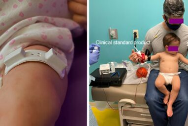 New sweat monitoring device doesn't require physical activity