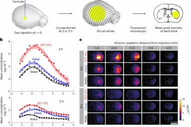 Scientists find sleep may not clear brain toxins
