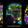 3D maps of diseased tissues at subcellular precision