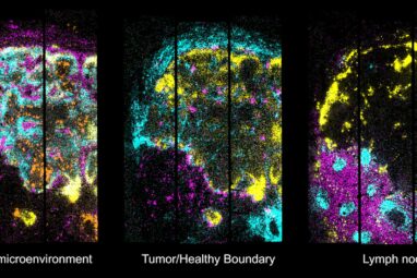 3D maps of diseased tissues at subcellular precision