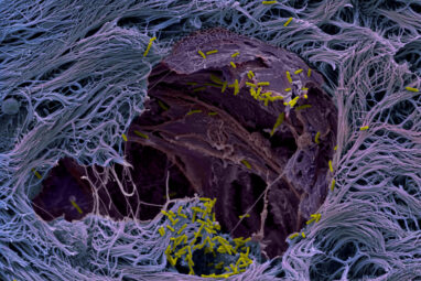 Lung organoids reveal how pathogens infect human lung tissue