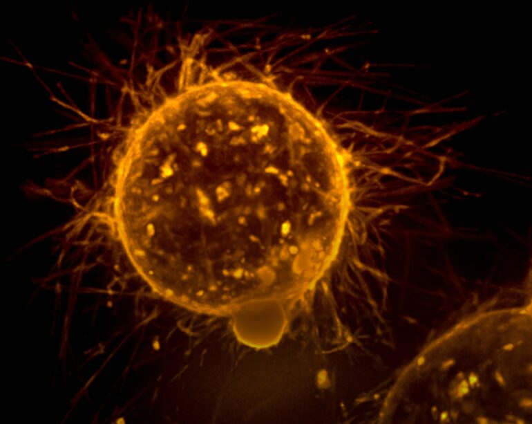 Some CRISPR screens may be missing cancer drug targets