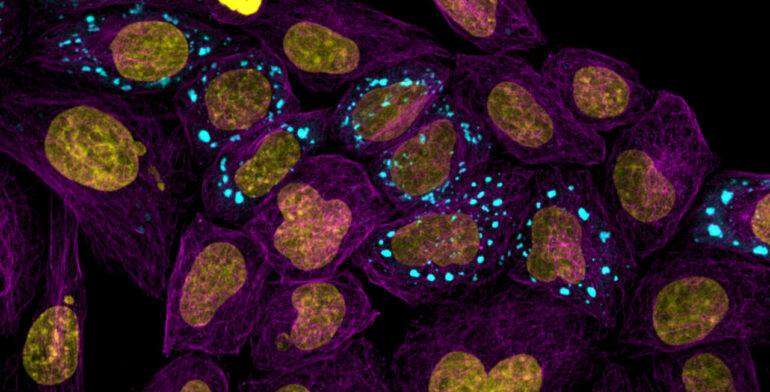 AI-powered atlas reveals how proteins behave inside cells