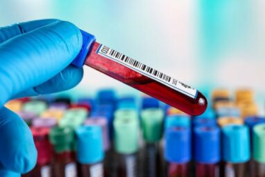 Blood test 91% accurate at predicting Alzheimer's, outperforming ...