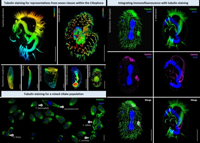 Ciliated eukaryotes study offers simple, versatile method for ...