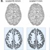 Study identifies universal blueprint for mammalian brain shape