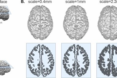 Study identifies universal blueprint for mammalian brain shape