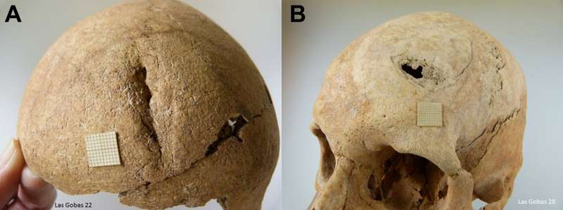 Study reveals isolation, endogamy and pathogens in early medieval Spanish community