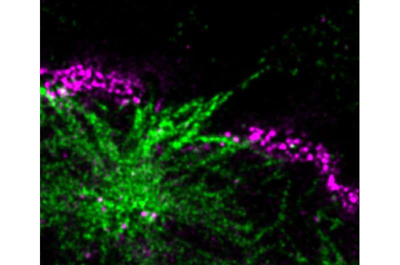 Exploring Huntington's disease, researchers discover that protein aggregates poke holes in nuclear membrane